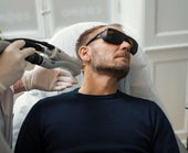 Permanent hårfjerning til mænd: De 5 mest populære behandlingsområder