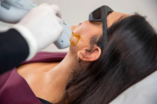 Laserbehandling hos Cosmo Laser: Klient med beskyttelsesbriller får behandling i ansigtet.