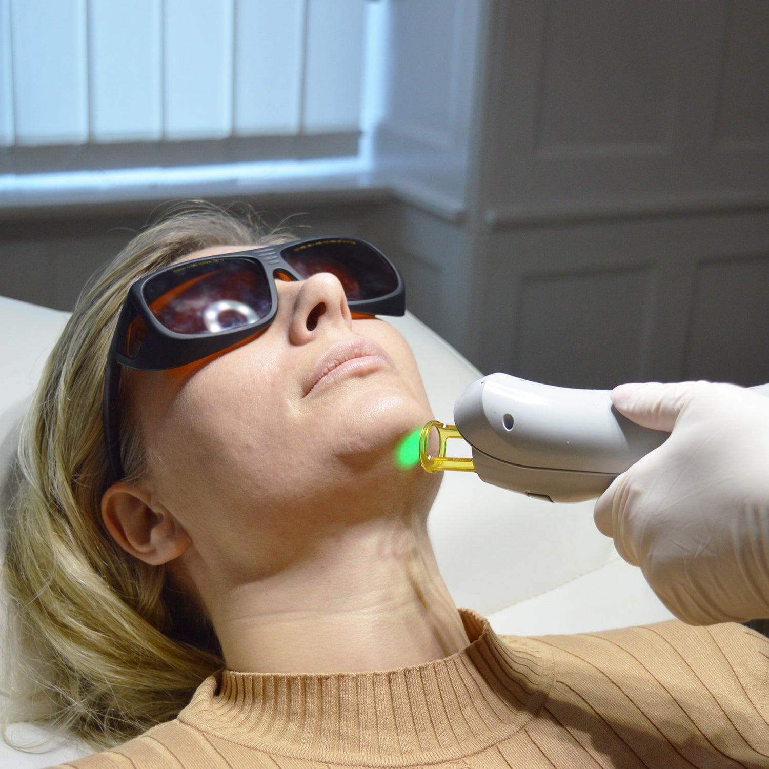 Laserbehandling af ansigt hos Cosmo Laser. Kvinde med beskyttelsesbriller får laserbehandling på hagen.