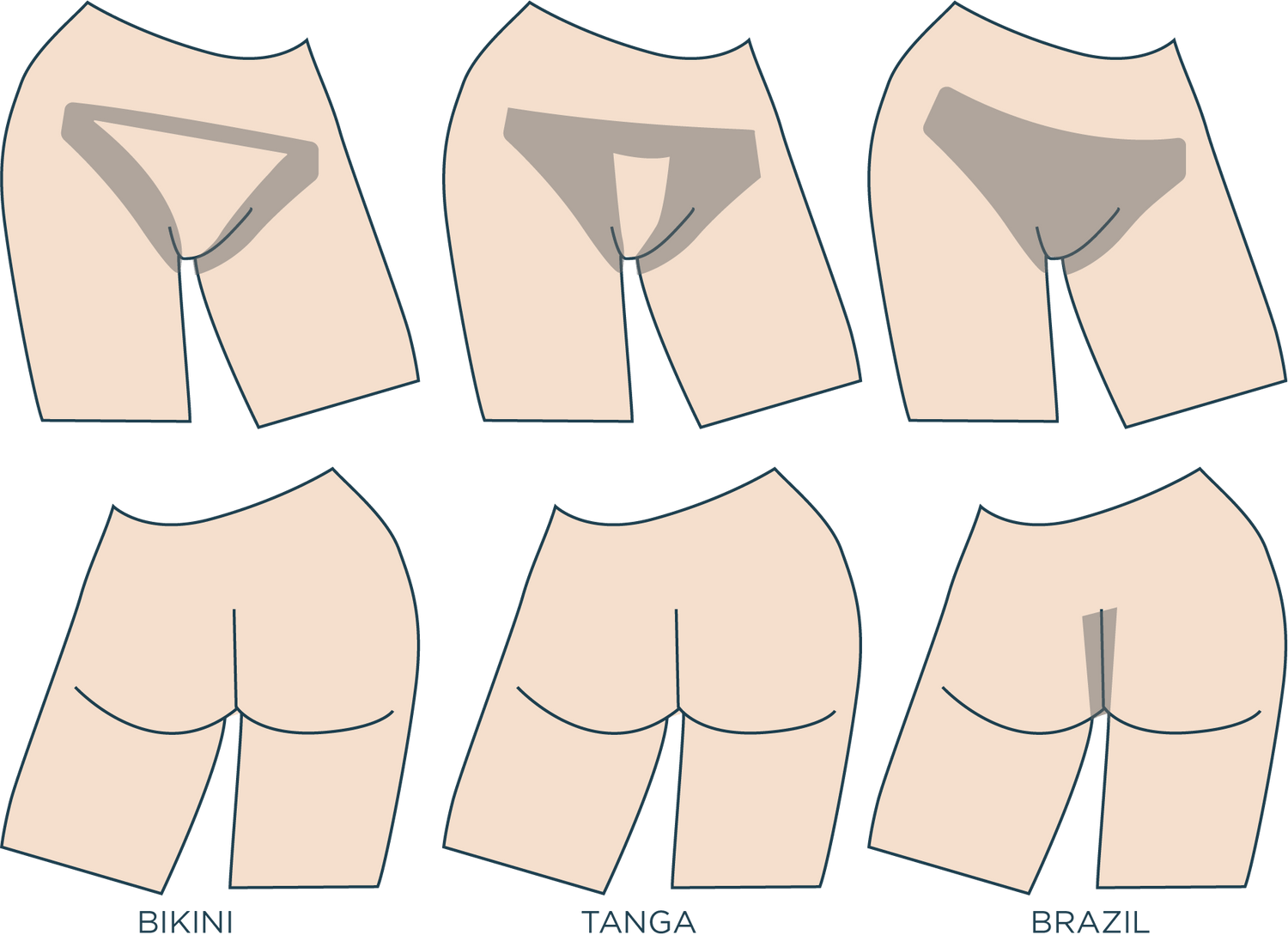 Illustration af bikinilinjer (bikini, tanga, brasiliansk) før hårfjerning med laser hos Cosmo Laser.