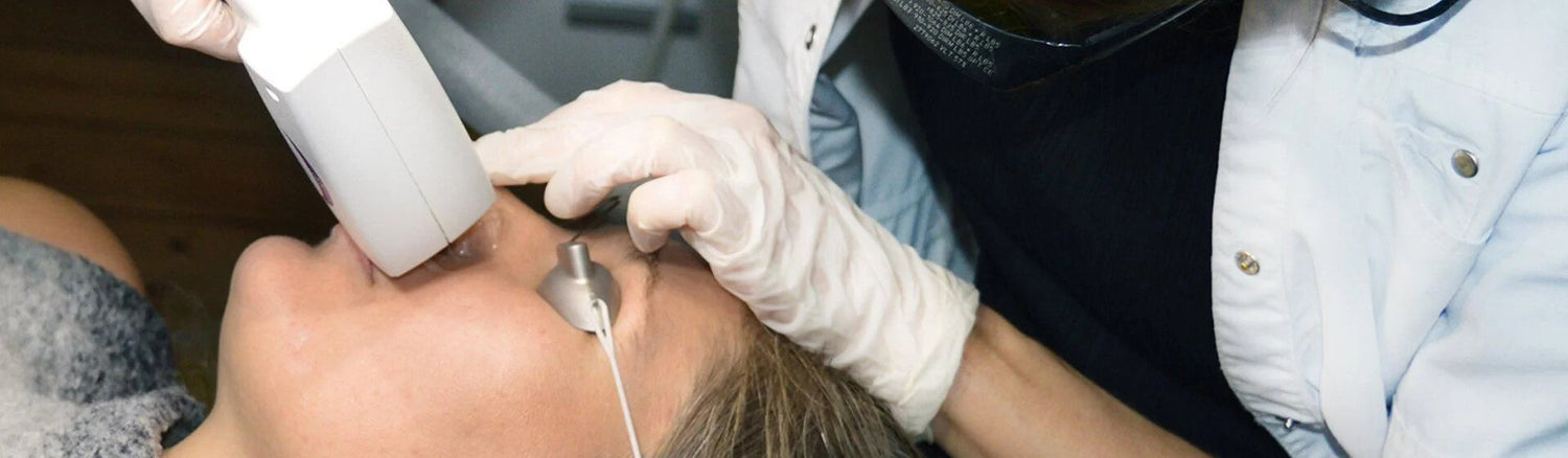 Cosmo Laser behandler karsprængninger og uønskede blodkar med laser. Sikker og effektiv behandling.