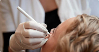 Botox behandling hos Cosmo Laser: Nærbillede af præcis injektion i panden.