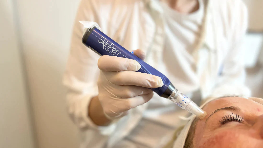 SkinPen behandling i gang.