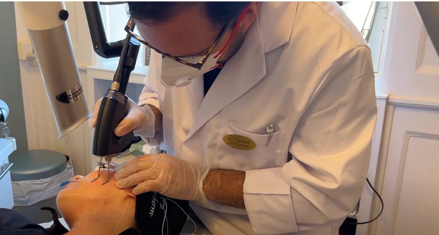 CO2 laserbehandling af ansigt hos Cosmo Laser. Dermatolog udfører præcis laserbehandling.