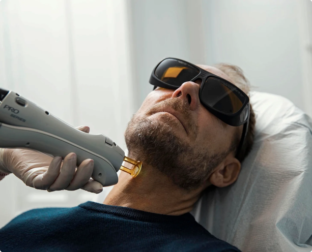 Laserbehandling af mandens hals hos Cosmo Laser. Sikker og effektiv hårfjerning med avanceret laserteknologi.