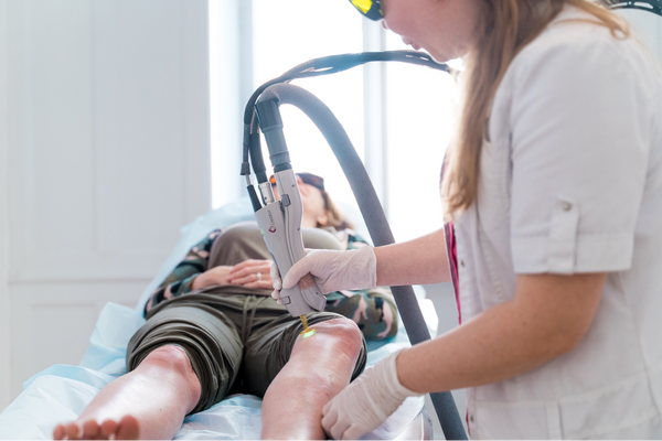Behandling med permanent hårfjerning på benene