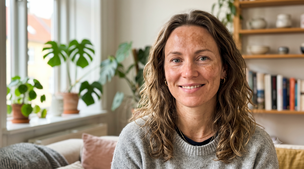 Slip af med pigmentforandringer: Lottes resultater med SkinPen & Skinkó E