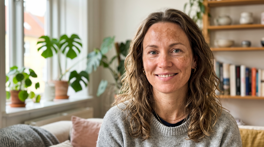 Slip af med pigmentforandringer: Lottes resultater med SkinPen & Skinkó E