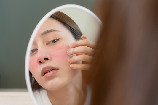 Hvad er rosacea?