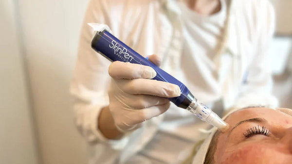 Få en SkinPen behandling i København