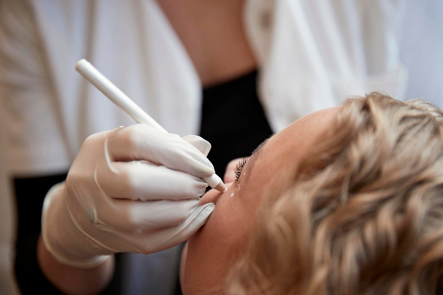 Botox behandling hos Cosmo Laser